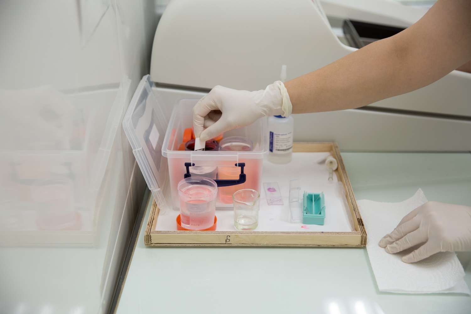 Bakı Patologiya Mərkəzi laboratoriyası